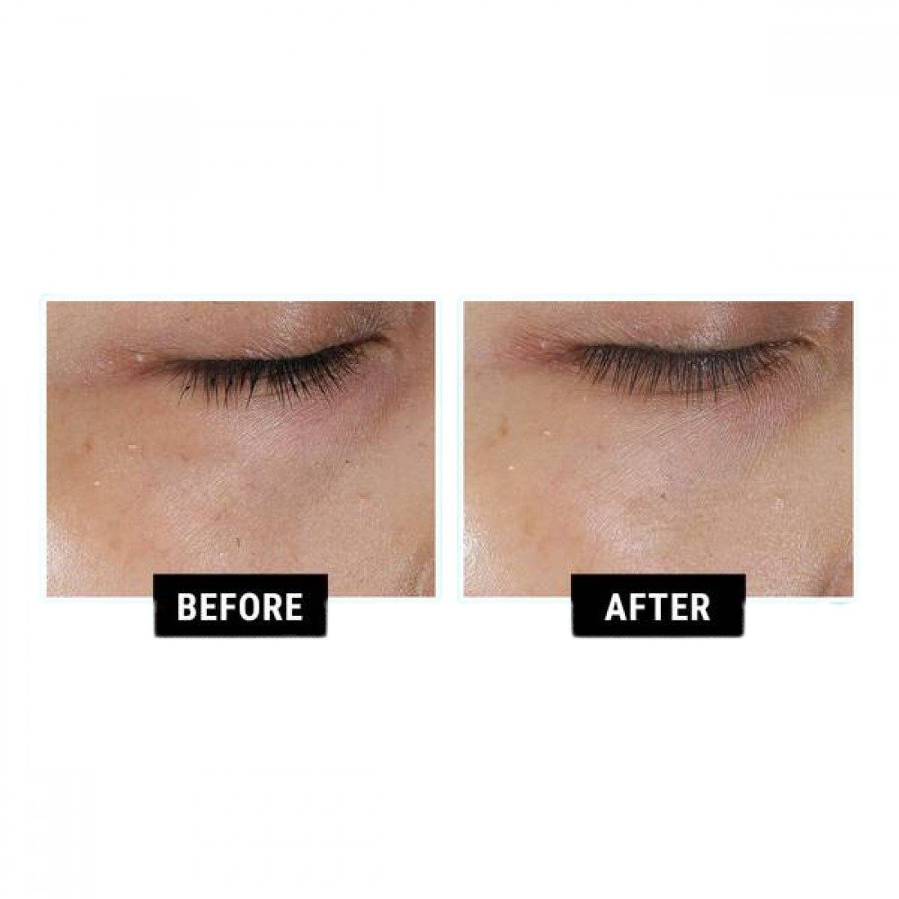 Kiehl's - Rare Earth Deep Pore Minimizing Clay Mask - 125ml