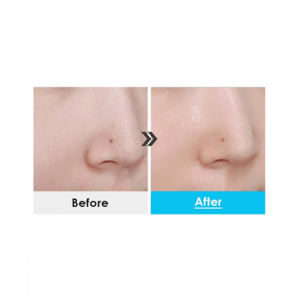 MEDIPEEL+ - Power Aqua Cream - 50g