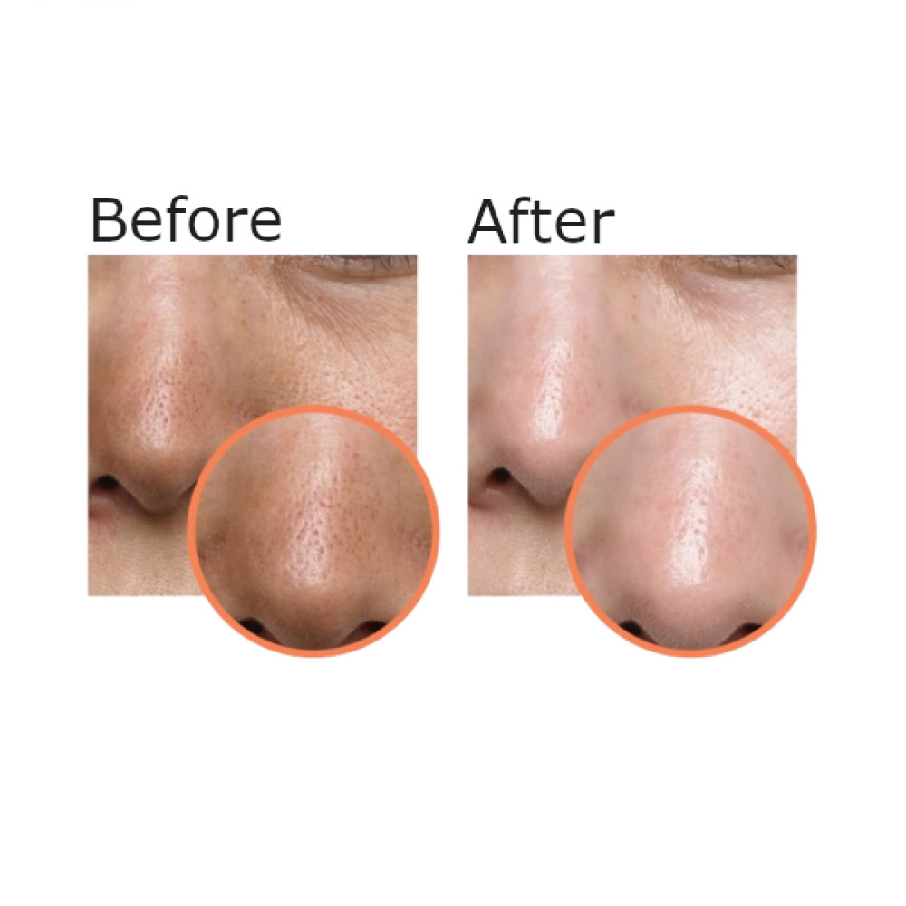 MEZCLAR - Skin Care Melting Cleansing Balm - 100ml