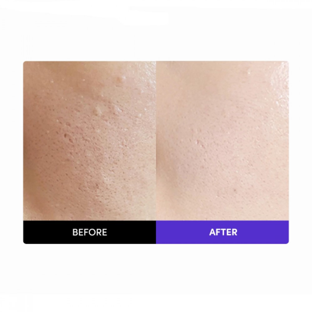 FRANKLY - Closer Serum - 100ml