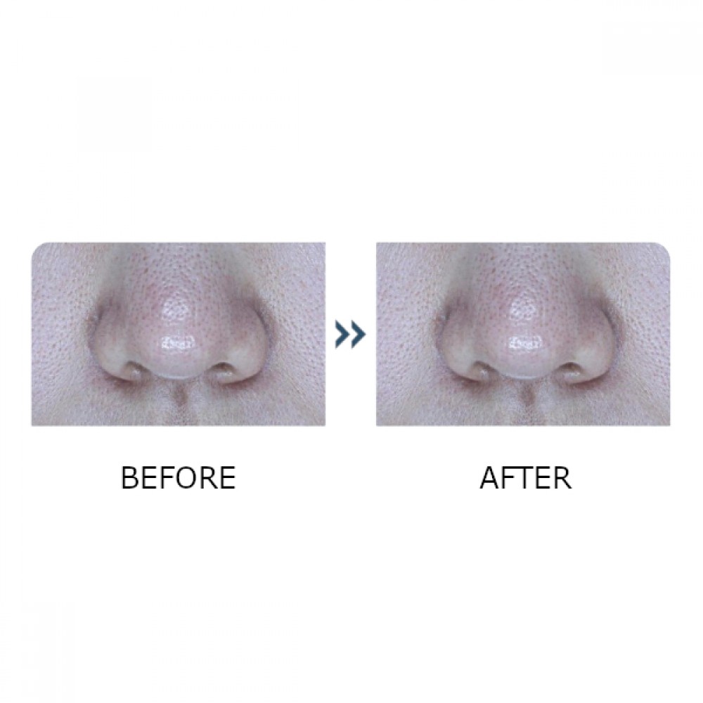 Round Lab - 1025 Dokdo Toner