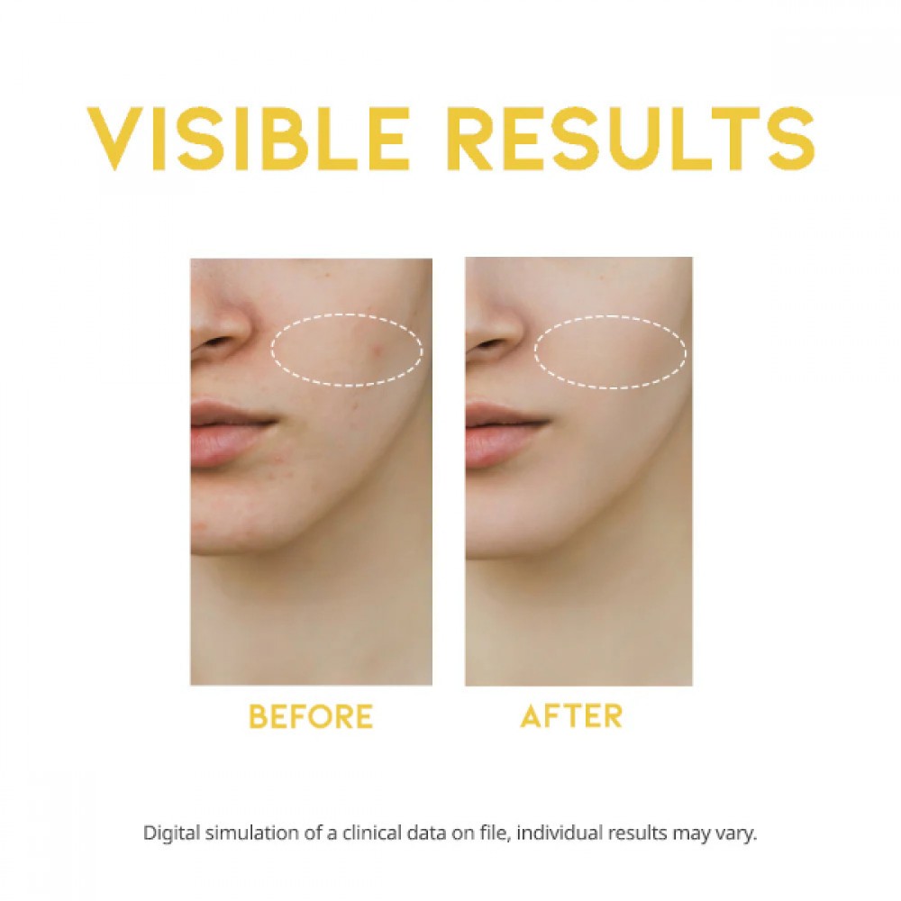 OOTD - Dark Spot Vitamin C Serum - 50ml