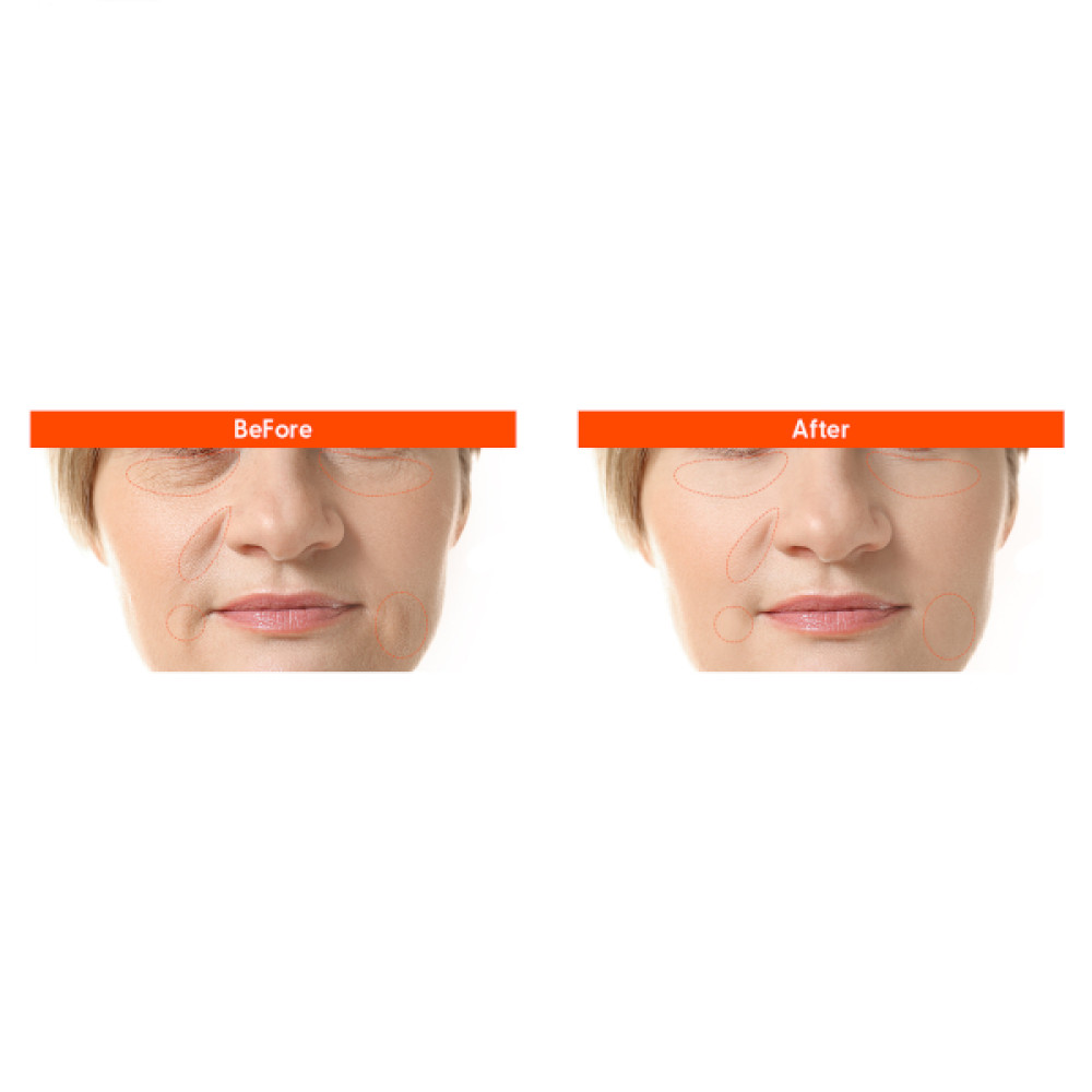 It's SKIN - Collagen Nutrition Serum+ - 40ml