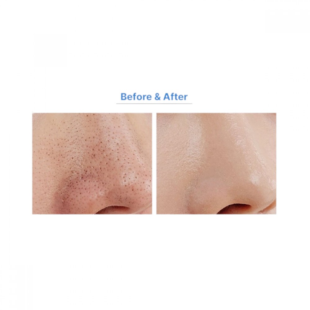 MEDIPEEL+ - Extra Super 9+ 2.0 - 250ml