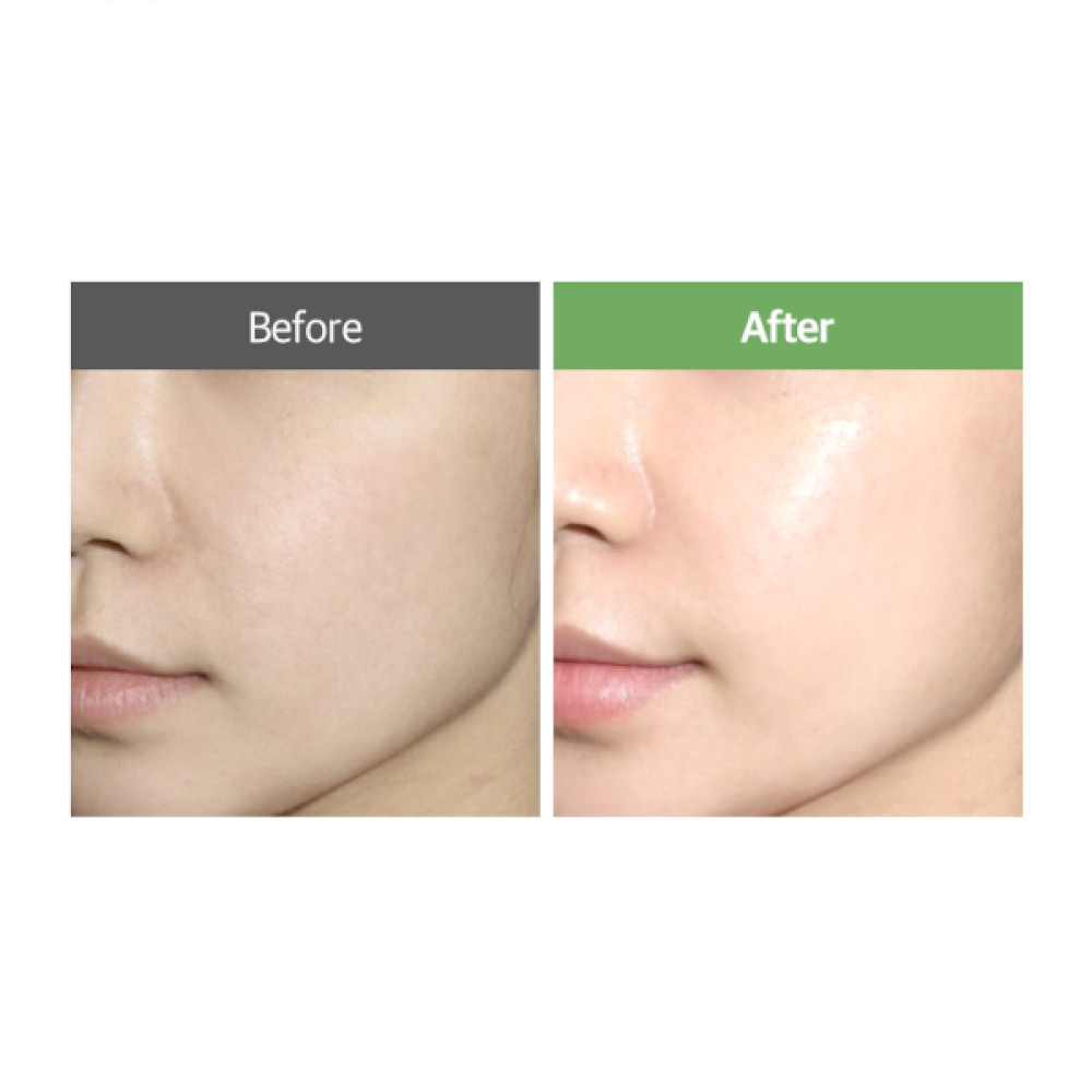 Veganifect - Clean And Glow Green Barley Serum Fit Mask - 5ea