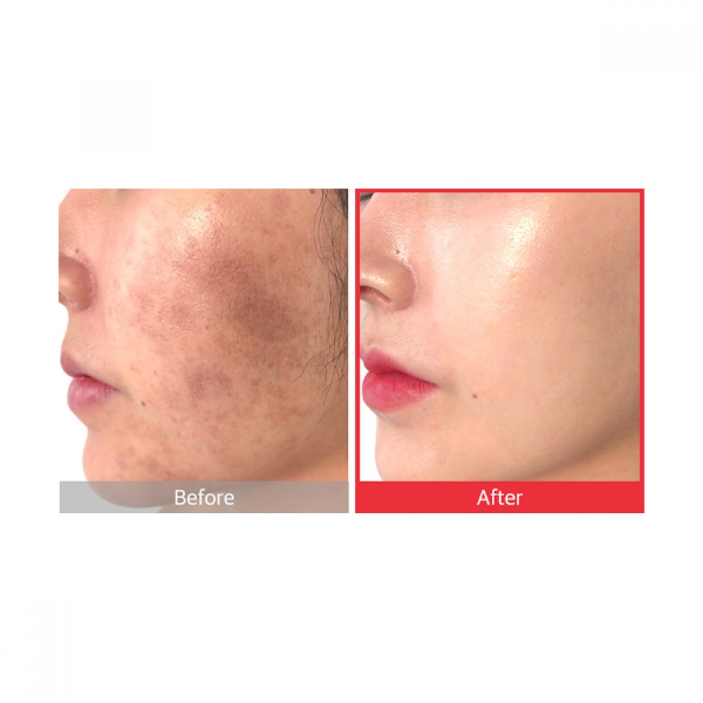 SOME BY MI - Snail Truecica Miracle Repair Toner - 150ml