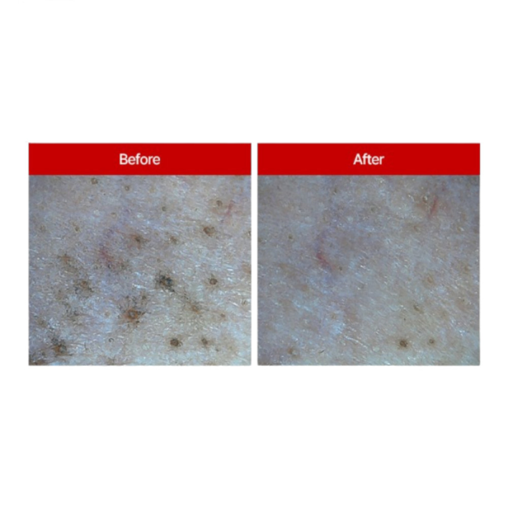 MEDIPEEL+ - Red Lacto Collagen Cleansing Balm - 100ml