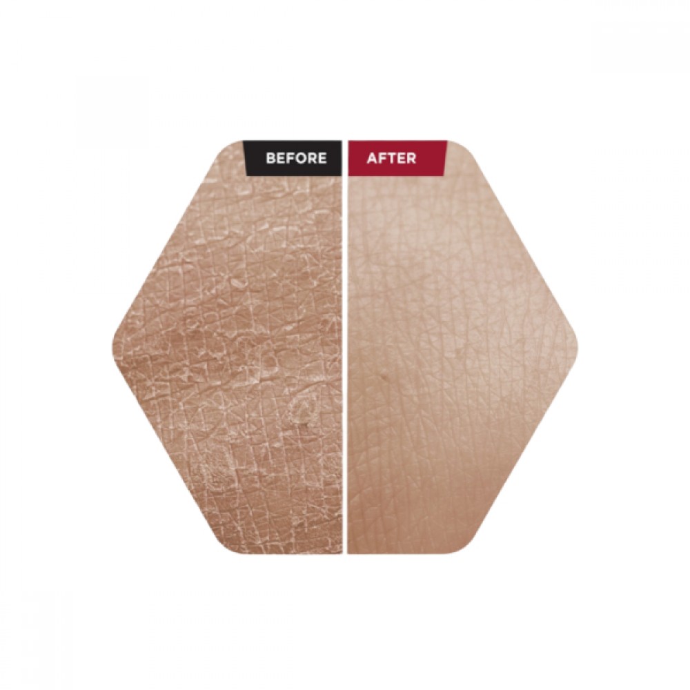 SKIN1004 - ZOMBIE BEAUTY by SKIN1004 Bloody Peel - 30ml