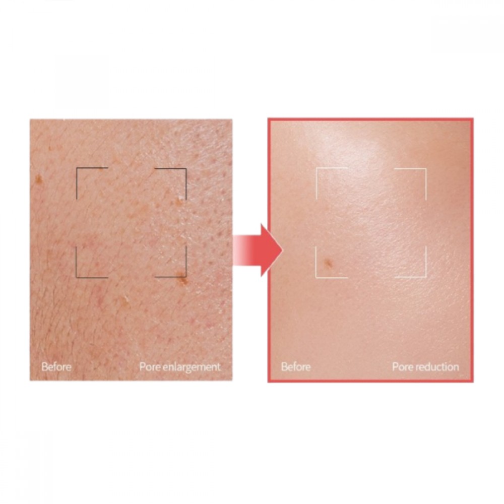 Veganifect - Lifting And Balancing Fig Chestnut Pore Fit Toner Pad - 70ea