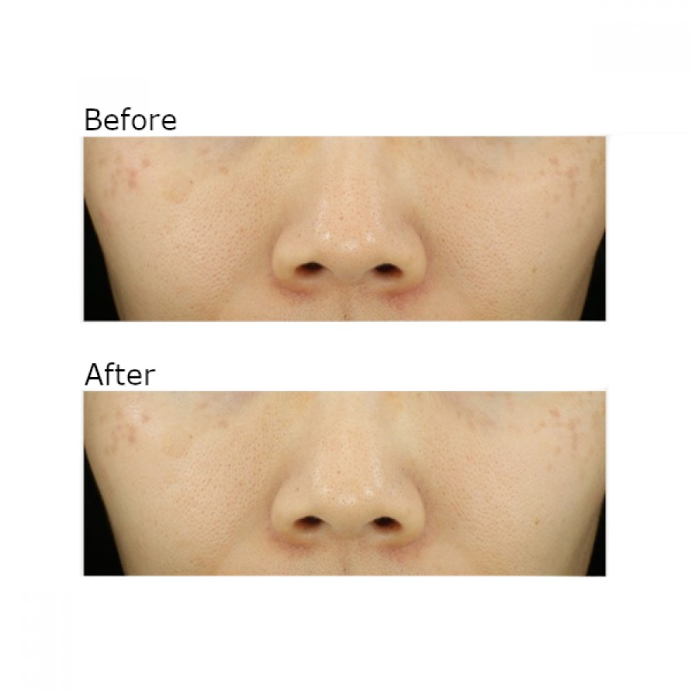 SOME BY MI - Yuja Niacin Anti Blemish Cream - 60g