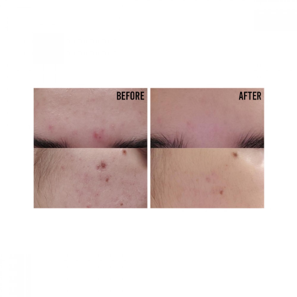 Cos De BAHA - Azelaic Acid 10% Serum (AZ) - 30ml