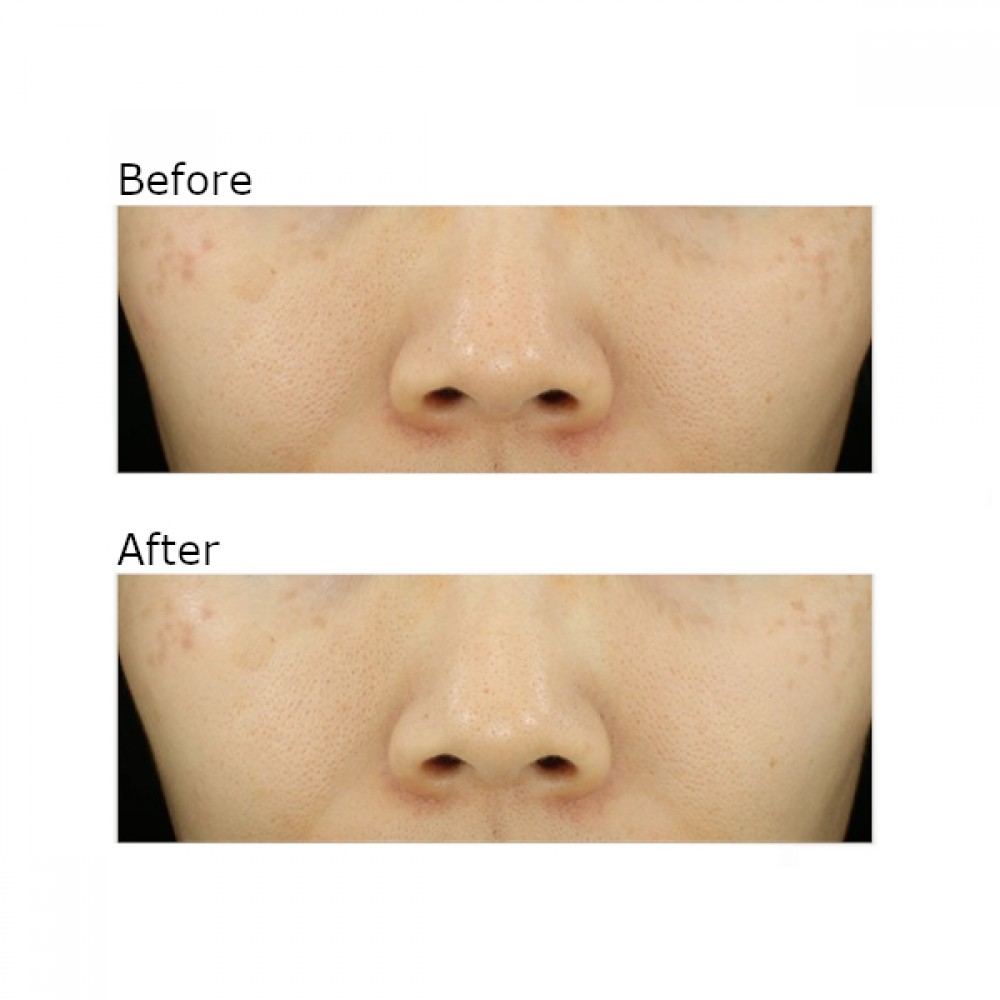 SOME BY MI - Yuja Niacin Anti Blemish Serum - 50ml