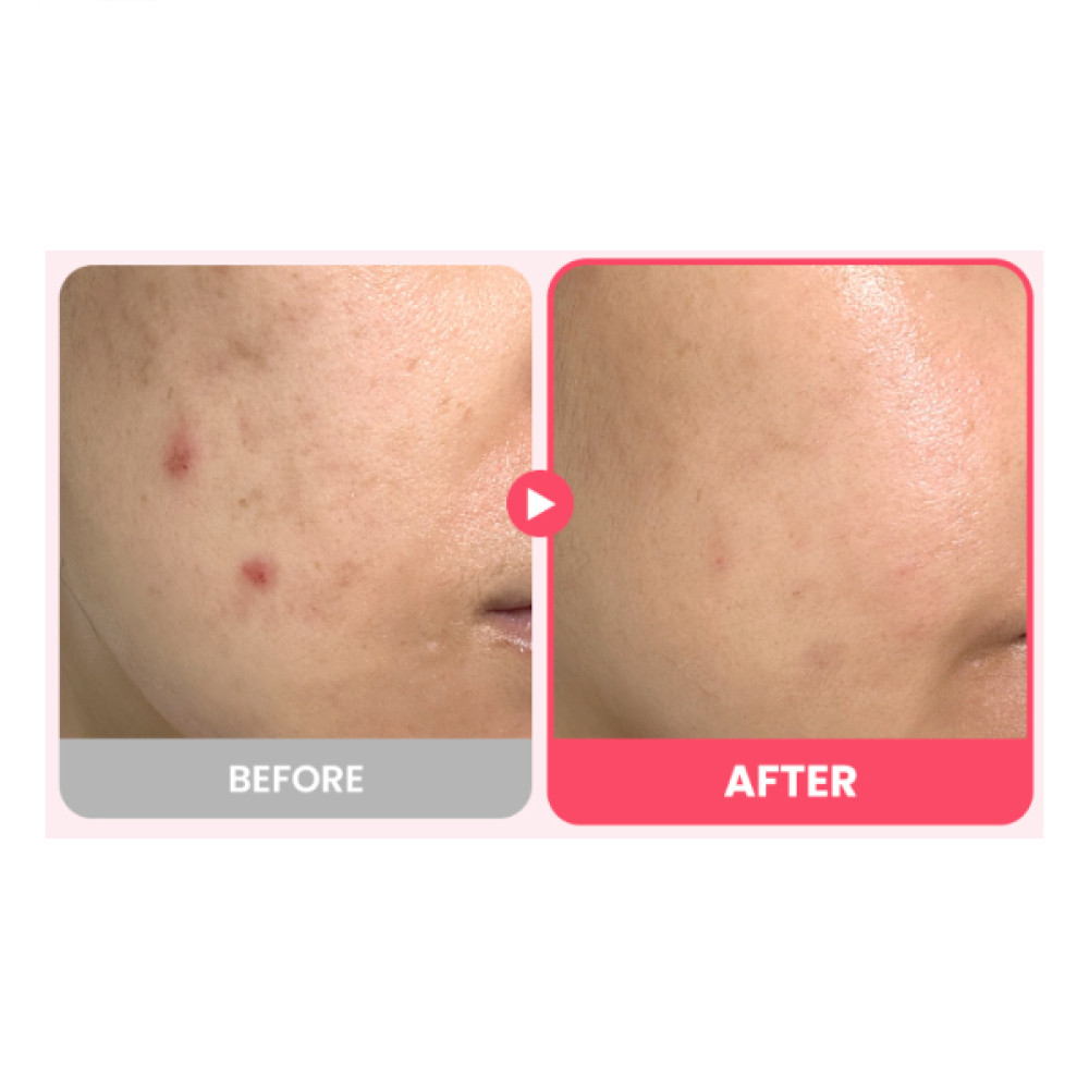 Dr.G - R.E.D Blemish Repair Soothing Cream - 50ml